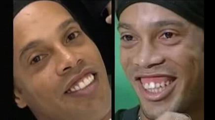 sonrisa de Ronaldinho
