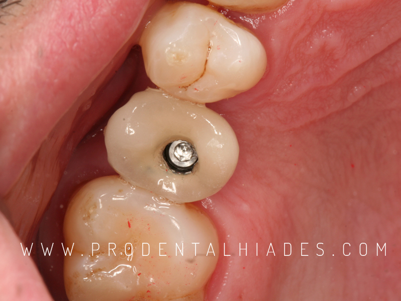 Clínica Dental Prodental Híades