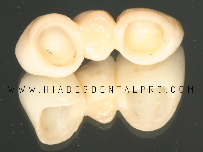 Clínica Dental Prodental Híades