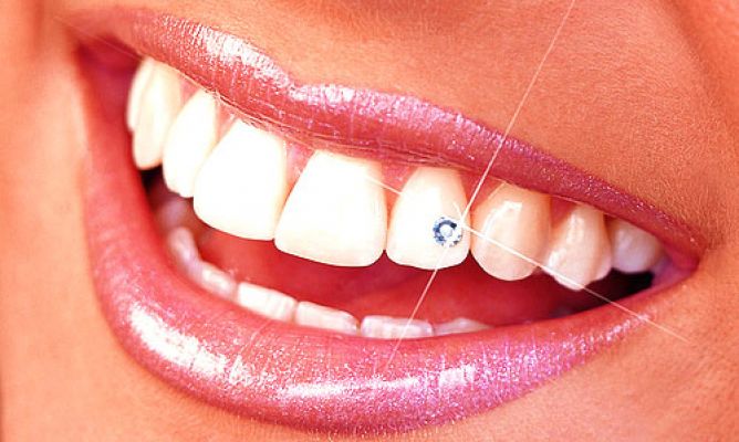 piercing-dental-668x400x80xx