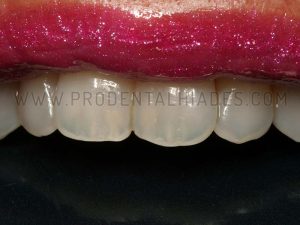 Estética Dental